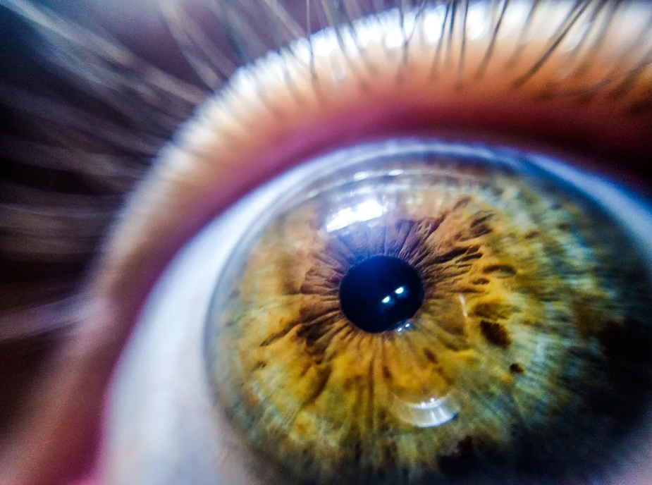 آسیب به سلول‌های بنیادی قرنیه توسط کم‌خوابی